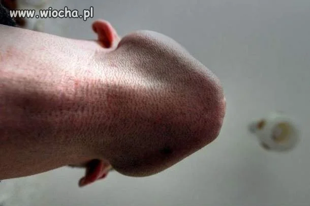 Koledzy mówią, że ch**owo wyglądam...