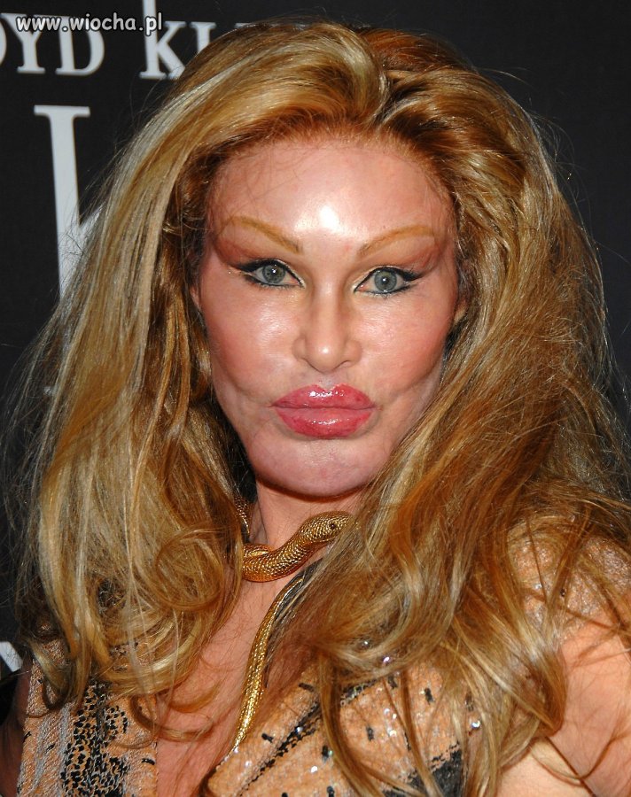 Element galerii