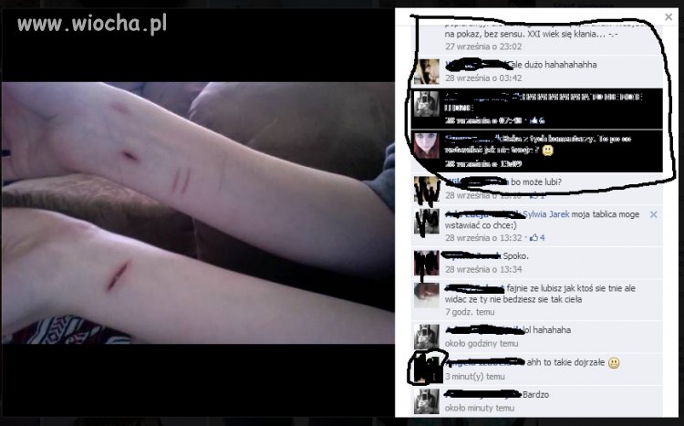Chwalić się pociętymi rękoma na fejsie