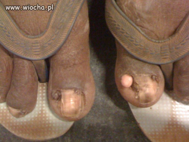 Przydałby się Pedicure 