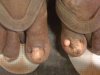 Przydałby się Pedicure 