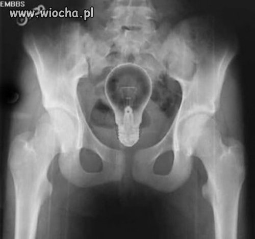 Więcej światła i wszystko jasne