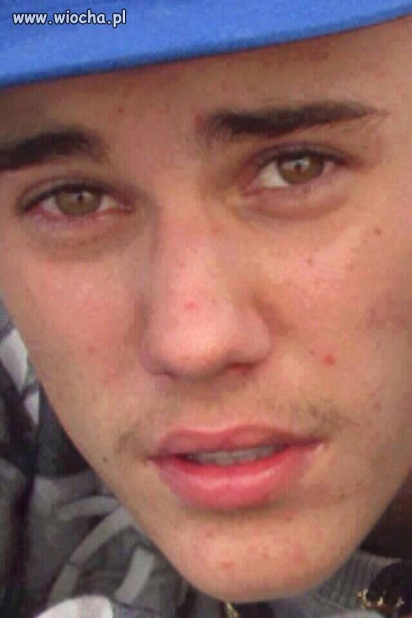 Justin Bieber bez makijażu+koper pod nosem