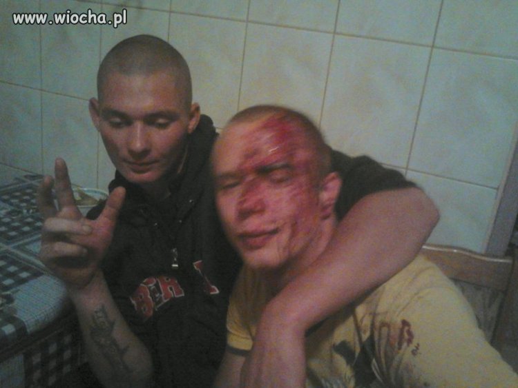 Dostałem Wpie*dol