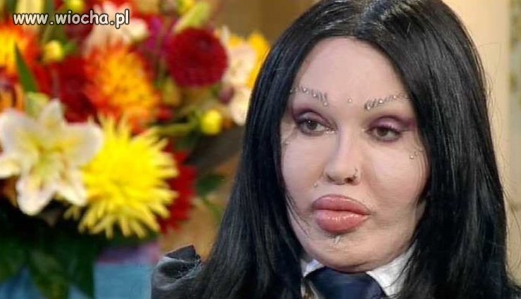 Pete Burns