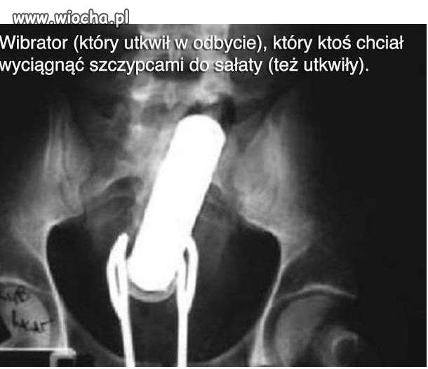 Rzeczy znalezione w odbytach ludzi na pogotowiu