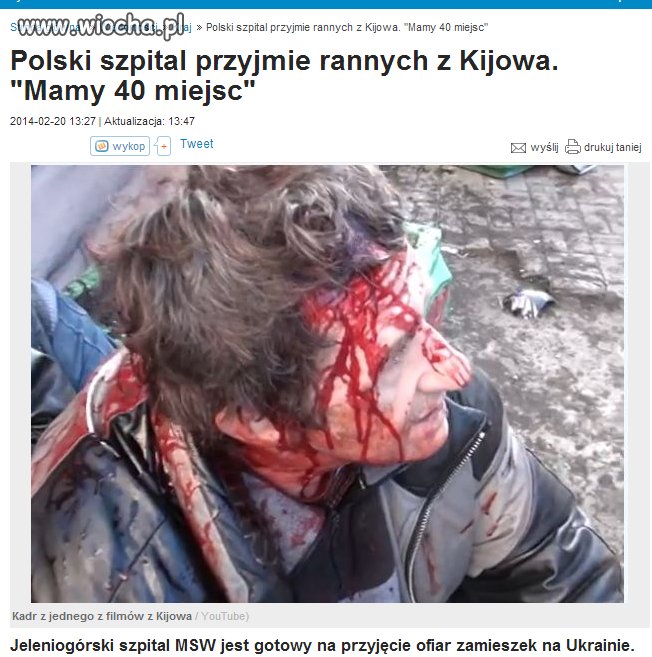 Darmowe miejsca w szpitalach dla rannych z Ukrainy