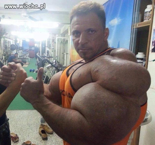 Synthol-man
