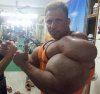 Synthol-man