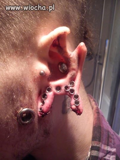 Piercing i jego efekty uboczne