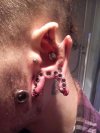 Piercing i jego efekty uboczne