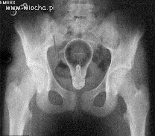 Światło w tunelu.