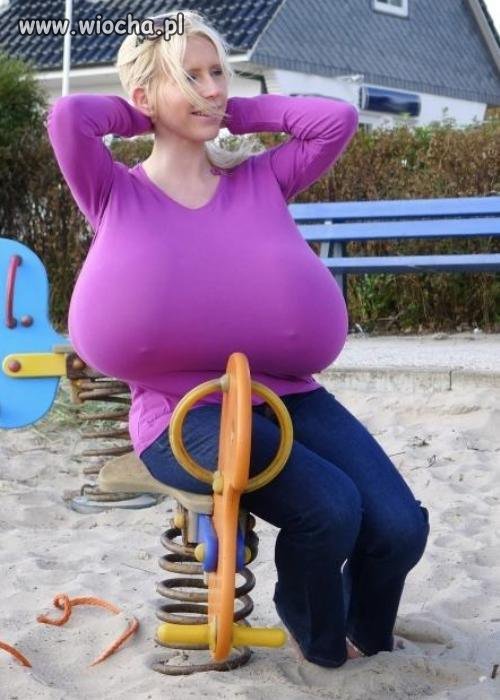 Chirurg zrobił ją w balona