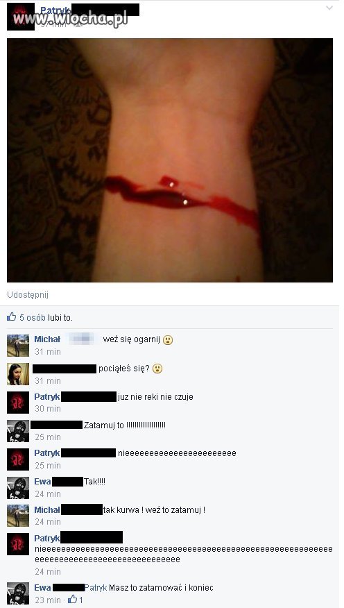 Pociął się więc trzeba się pochwalić na FB