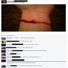 Pociął się więc trzeba się pochwalić na FB