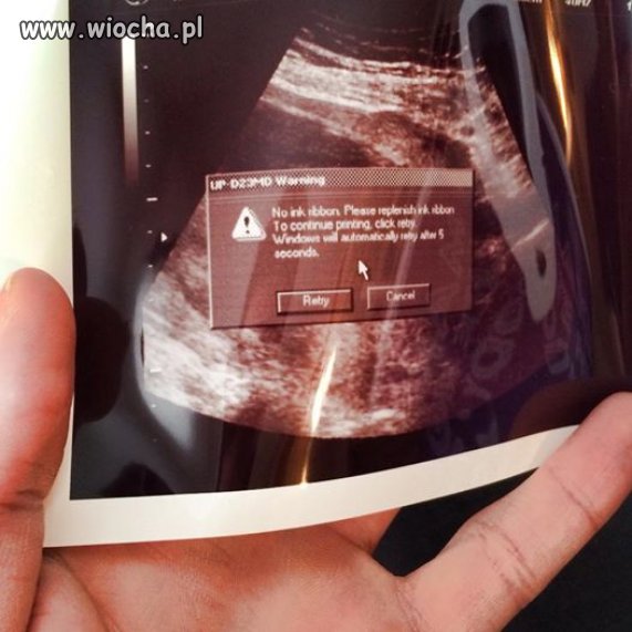 Zdjęcie z badania USG