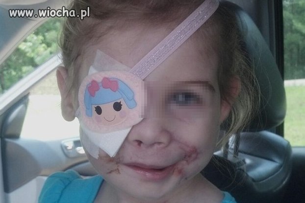 Wyrzucono dziewczynkę z KFC bo była za brzydka