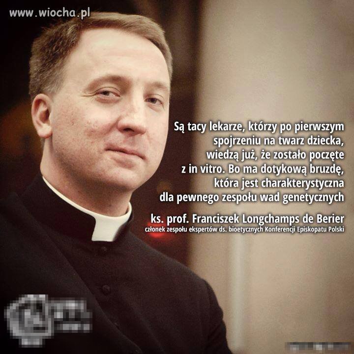 A ja po twarzy stwierdzam że ten pan jest gejem 