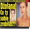 Wampirzy lifting relacja na żywo
