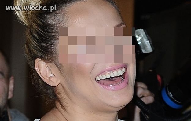 Zamazali oczy i nie wiem kto to 