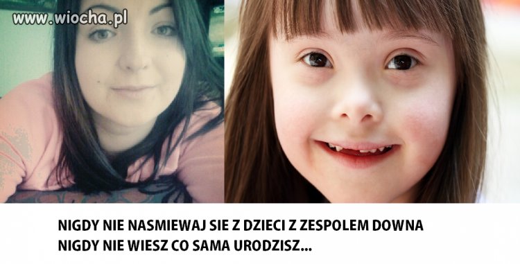 Zespol downa