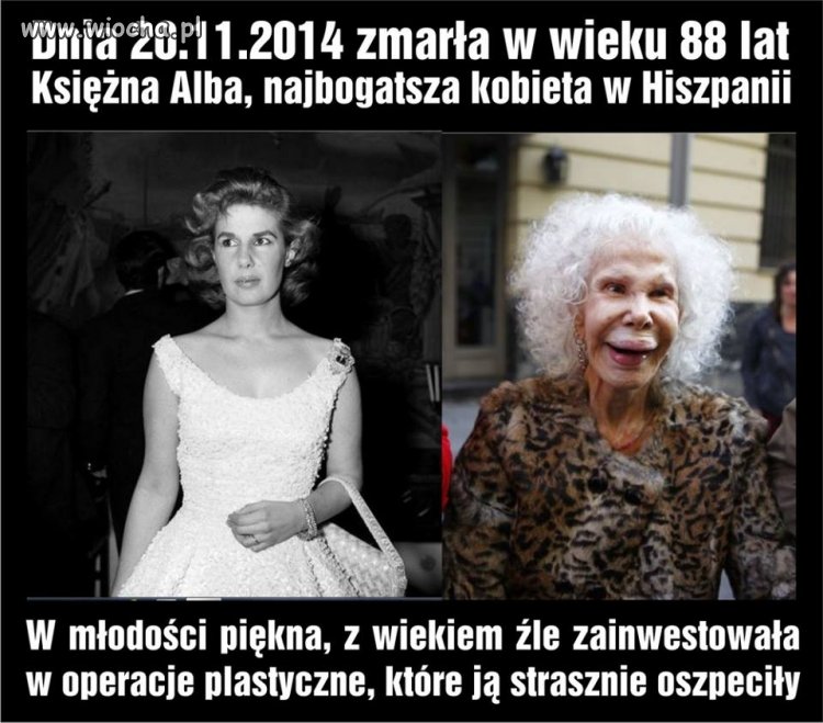 Drogie panie zastanówcie się dobrze