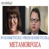 Metamorfoza