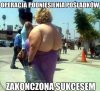 Operacja