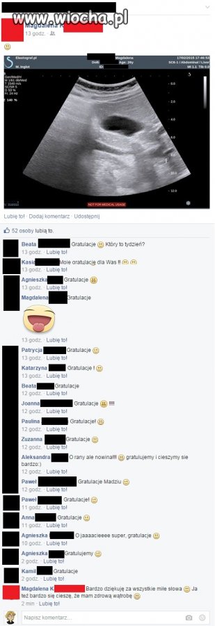 Zdrowa wątroba