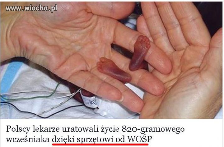 Dając na WOŚP widzisz efekty...