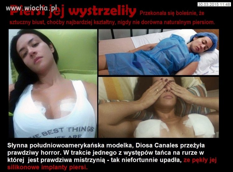 Piersi jej wystrzeliły