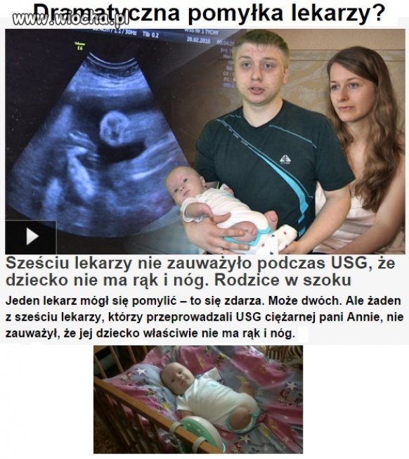 Sześciu lekarzy nie zauważyło braku rąk i nóg  