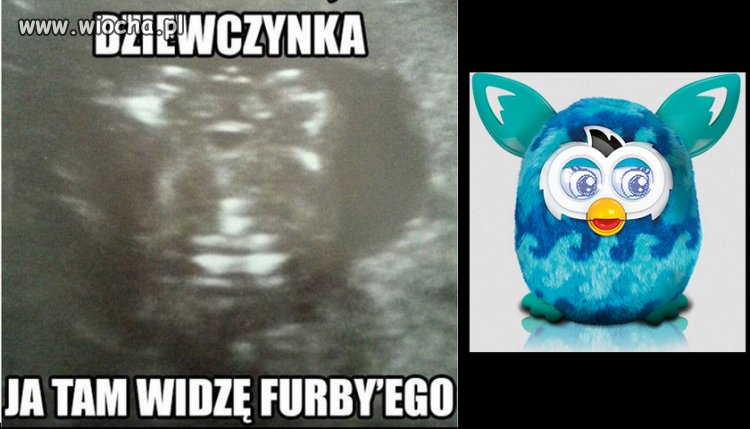USG ciąży 