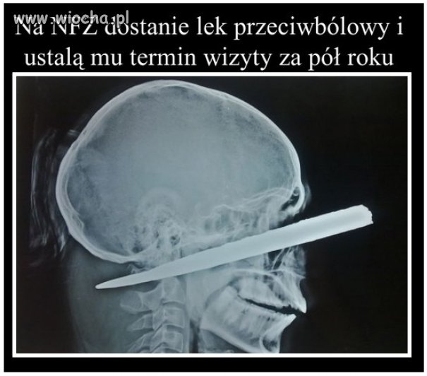 Zapewne tak by było