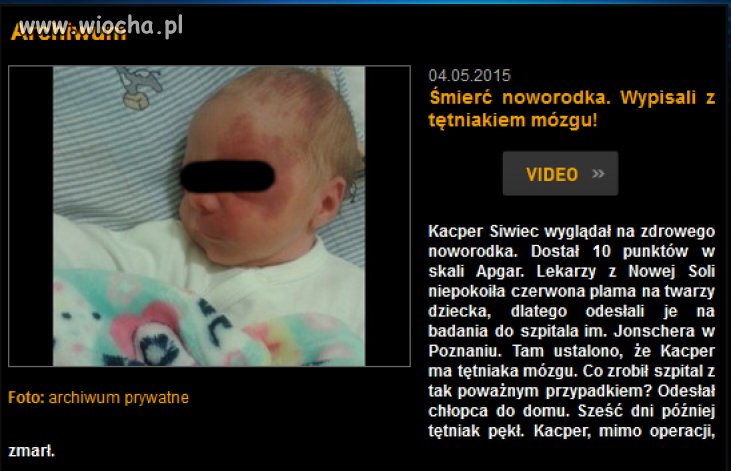 To się w głowie nie mieści
