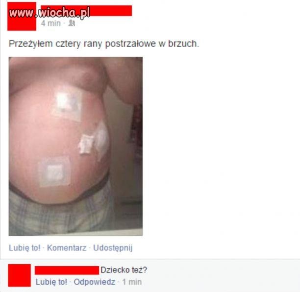Rany postrzałowe