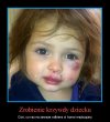 Zrobienie krzywdy dziecku