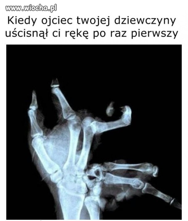 Ręka
