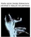 Ręka