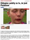 Ciemne strony emigracji. 