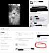 Dziecko w ciąży świeci brzuchem na fejsbuku