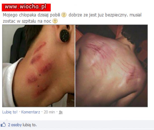 Ciężkie pobicie