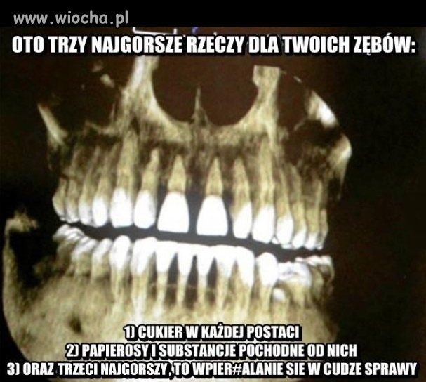 3 rzeczy