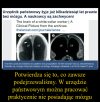 Jedynym „odchyleniem” od normy był u niego