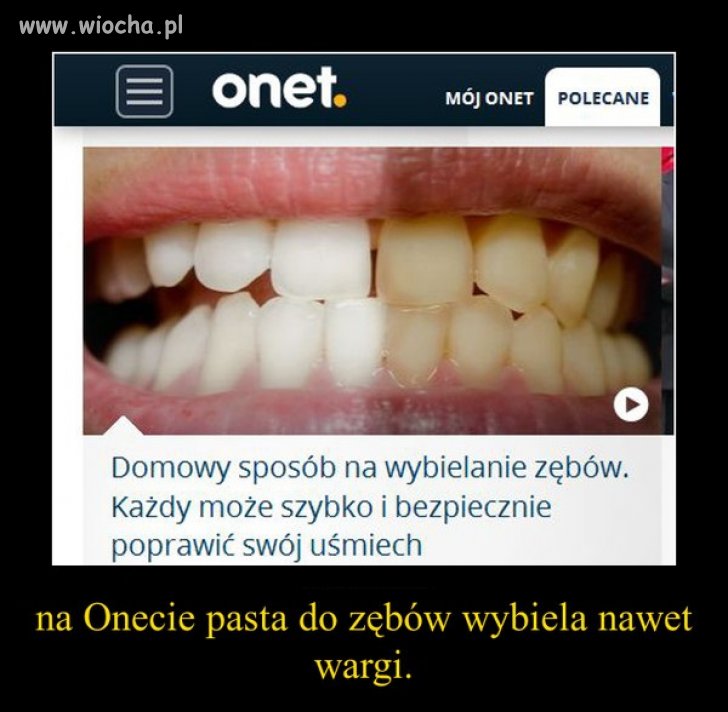 Onet i jego *fejki*