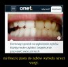 Onet i jego *fejki*