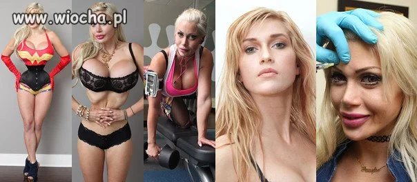 Usuneła 6 kości aby być inna.