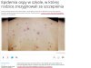 Epidemia w ramach liberalnych poglądów