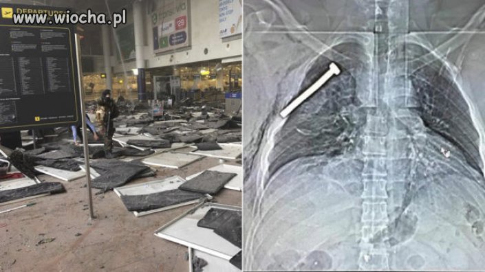 Belgia; W ciałach ofiar gwoździe i śruby 
