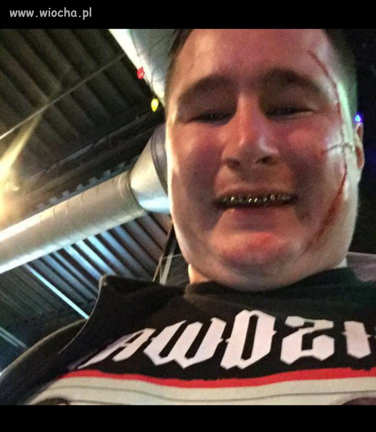 Pseudo Popek 2